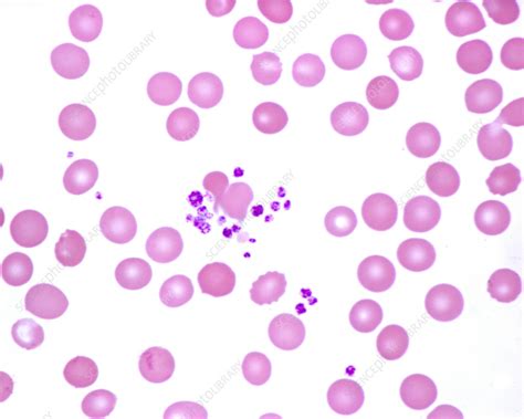 Human Blood Smear With Platelets Light Micrograph Stock Image C055