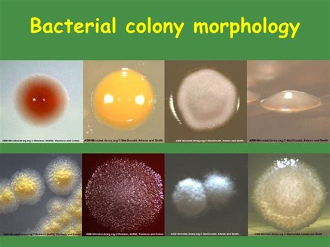 34 Colony Morphology Identifying Bacteria On Agar Plates Pictures Pics