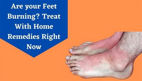 Home Remedies For Burning Feet Treat Burning Sensation In Feet With Home Remedies Livlong