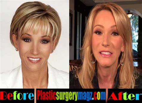 Paula White Plastic Surgery Before And After Plastic Surgery Magazine
