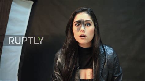 Brazilian Model Mariana Mendes Says Large Facial Birthmark Hasnt Held