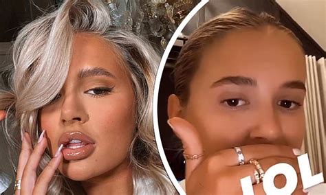 Molly Mae Hague Reveals Shes Dissolved Her Lip Fillers Daily Mail Online