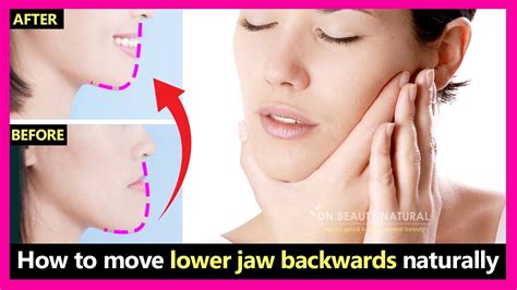 How To Fix Underbite Protruding Jaw Move Lower Jaw Backwards