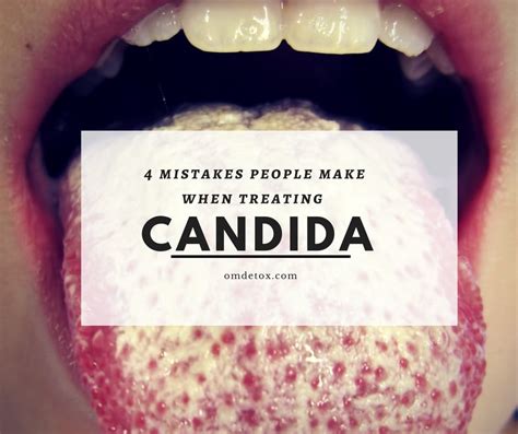 4 Mistakes Made While Treating Candida How To Treat Candida
