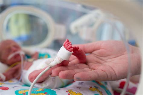 Por Que O Acompanhamento Com Neuropediatra Para Bebês Prematuros