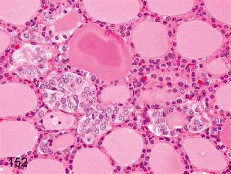 Thyroid Histology C Cells