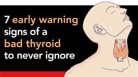 7 Early Warning Signs Of A Bad Thyroid To Never Ignore