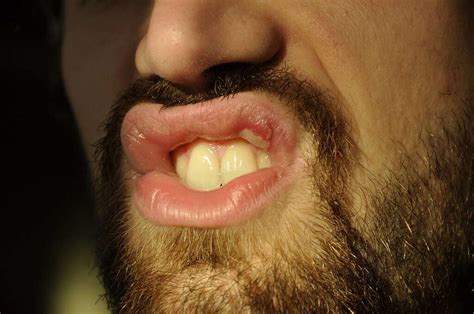 Sores In Throat Causes 10 Causes Of Sores In Your Throat