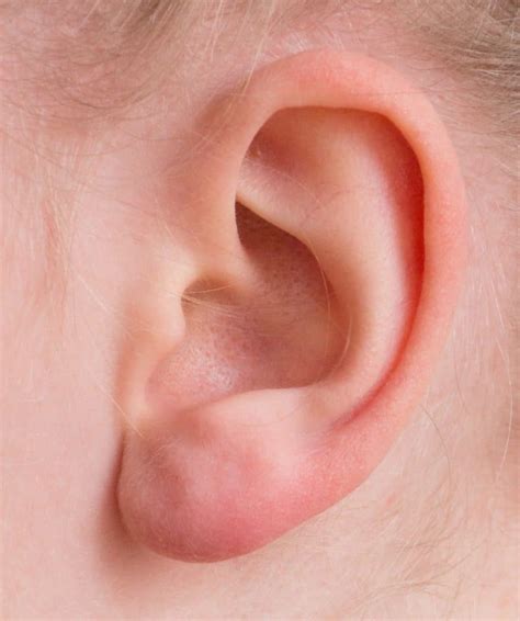 Was Tun Gegen Ohrenschmerzen Rotlicht Anwendung