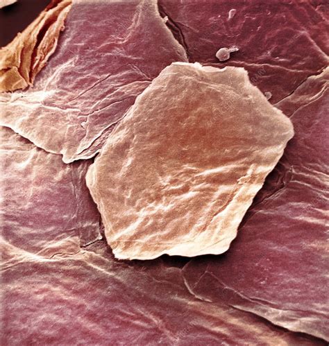 Skin Cell SEM Stock Image C001 7933 Science Photo Library