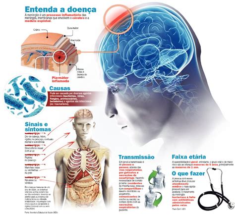 Tratamento Da Meningite Exige Atendimento Imediato Veja Os Sintomas Da Doença Viver Com Saúde