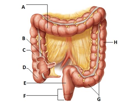 The cecum (the widest part of large intestine) leads to the ascending (right) colon, which ascends vertically from right iliac fossa through the right lumbar region into right hypochondrium under the liver. Label the Large Intestine (Colon)