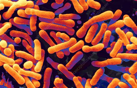 Bifidobacterium Animalis Stock Image B2201482 Science Photo Library