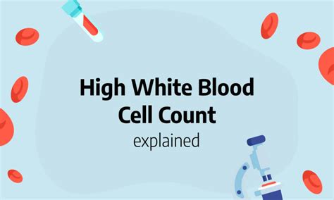 High White Blood Cell Count Causes Symptoms And More