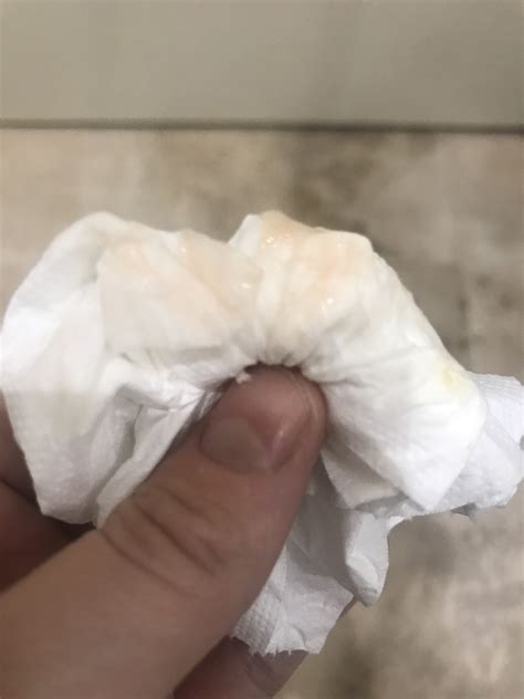 Maybe you would like to learn more about one of these? PINK discharge early pregnancy (TMI with pic) | Mumsnet