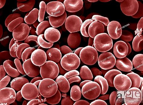 Scanning Electron Micrograph Sem Human Red Blood Cells Stock Photo
