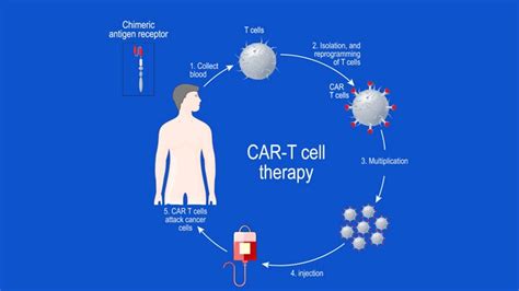 Overview Of Key Early Phase Car T Cell Therapy Studies In Relapsed Or