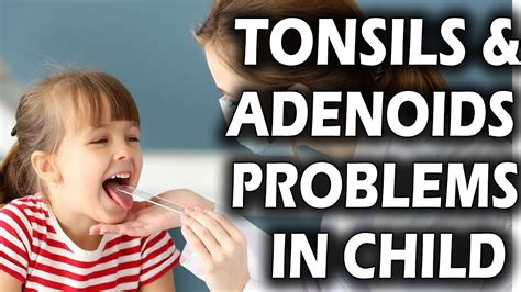 Tonsils And Adenoids Problems In Children Tonsils Problem Dr