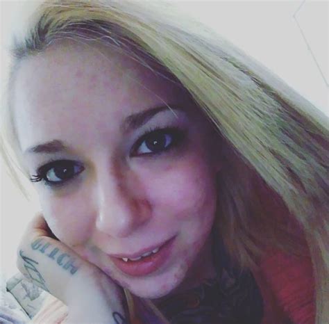 Woman Undergoing Years Of Laser Treatment To Undo Tattooed Face Metro