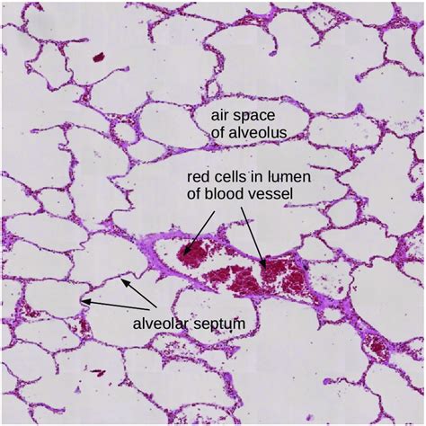 Label The Histology Of The Lung