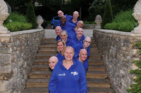Charity Calendar Featuring Alopecia Sufferers Mirror Online