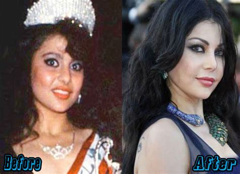 Haifa Wehbe Plastic Surgery Before And After Plastic Surgery Facts