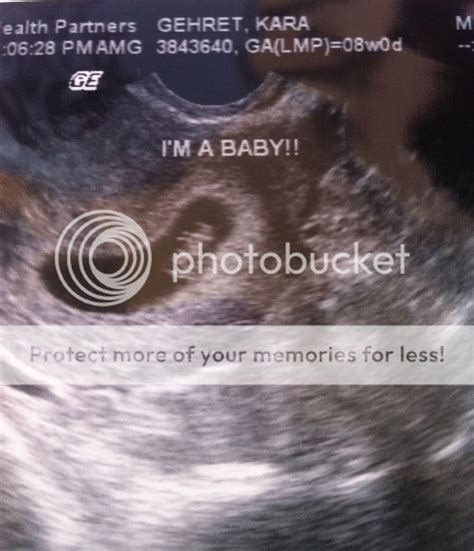 Share Your 8 9 Weeks Ultrasound Pics And Baby Bumps Here Babycenter