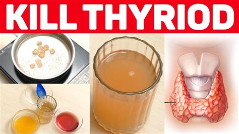 how to cure thyroid naturally and permanently home remedies for thyroid youtube
