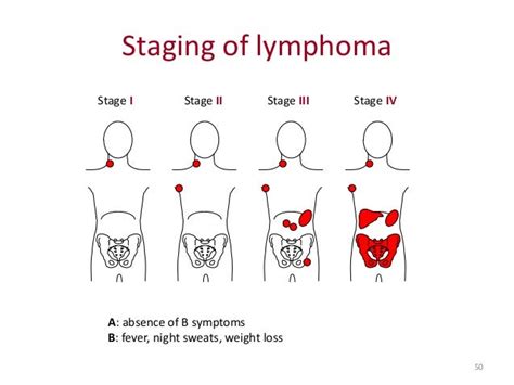 Hodgkin Lymphoma