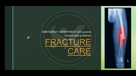 Fracture Care Guidelines General Ed Guidelines Youtube