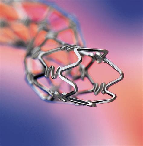 Heart Stents Still Overused Experts Say The New York Times