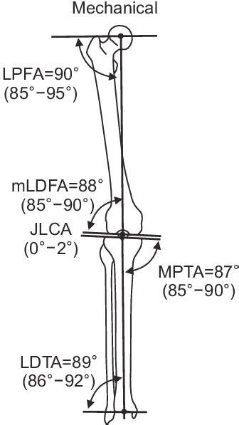 Adult Limb Deformity And Correction Recon Orthobullets