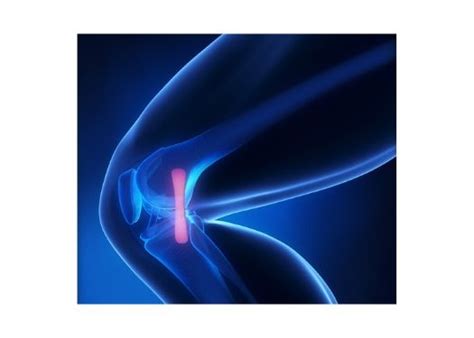 Mcl Injury Torn Mcl Knee Specialist South Windsor Enfield