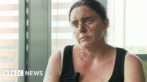 Three Questioned Over Southampton Acid Attack Bbc News