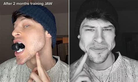 Male Model Reveals Very Dramatic Face Transformation After Training His Jaw For Months
