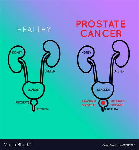 Prostate Cancer Logo Icon Royalty Free Vector Image