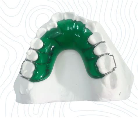 In the past, once you lost all your teeth, the only way to replace them was a denture. Dental Mara Orthodontic Appliance From China Dental Lab ...