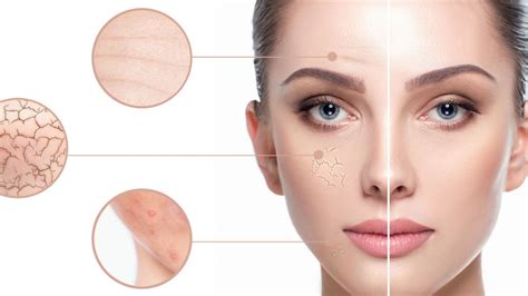 Clogged Pores On Face Types Causes And Removal Tips