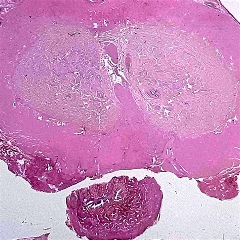 Pathology Outlines Anatomy Histology Penis