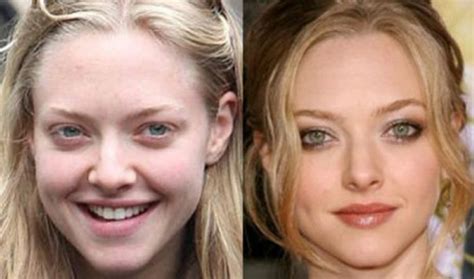 Amanda Seyfried Before And After Plastic Surgery 18 Celebrity