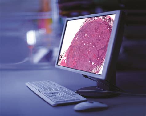 Digital Pathology Austinlader