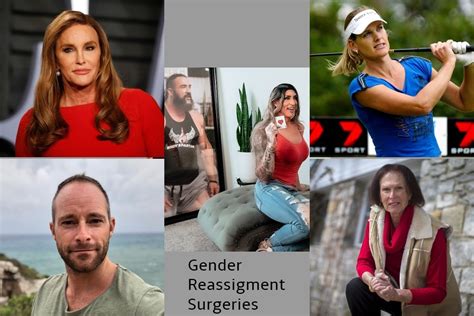 Document Your Gender Reassignment Surgery Medi Tec Blog