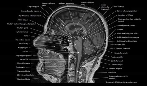 Brain Atlas Of Human Anatomy With Mri Mri Brain Mri Anatomy Images