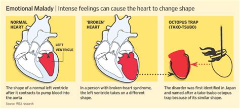 Broken Heart Syndrome Cardiac Health
