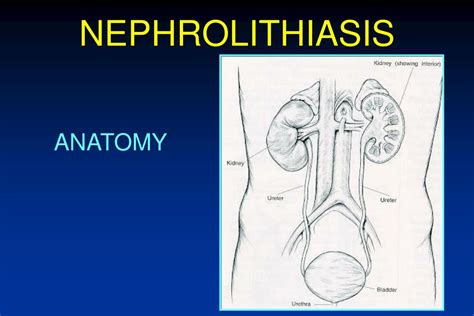 Ppt Advances In The Management Of Nephrolithiasis Powerpoint