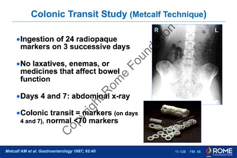 Bowel 126 Colonic Transit Study Metcalf Technique Rome Online