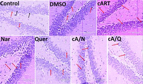 Dentate Gyrus In The Hippocampus Of Rats Groups Control