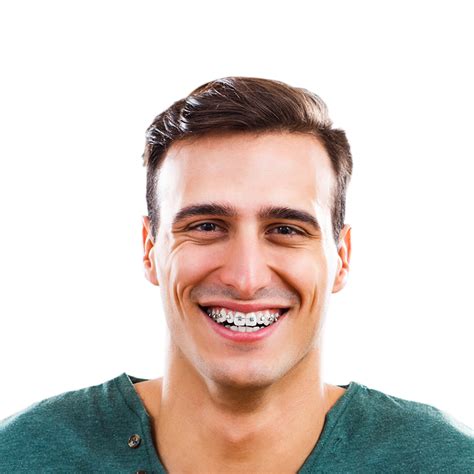Adult Orthodontics Mitchellville Md Silver Spring Md Bowie Md