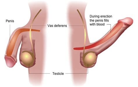Female Urologist Erection