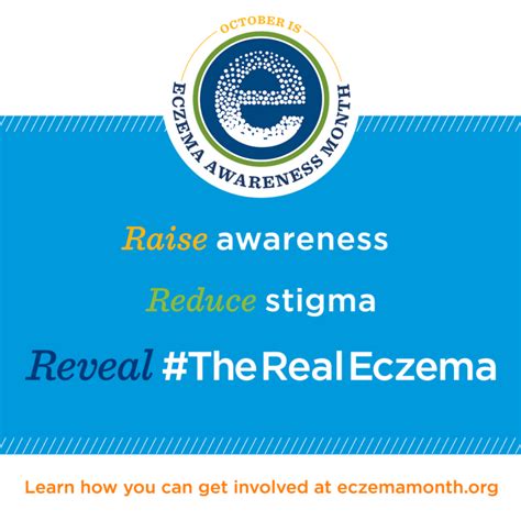 October Eczema Awareness Month Knoxville Institute Of Dermatology